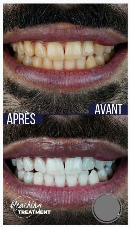 Retrouvez le sourire parfait dès aujourd'hui!