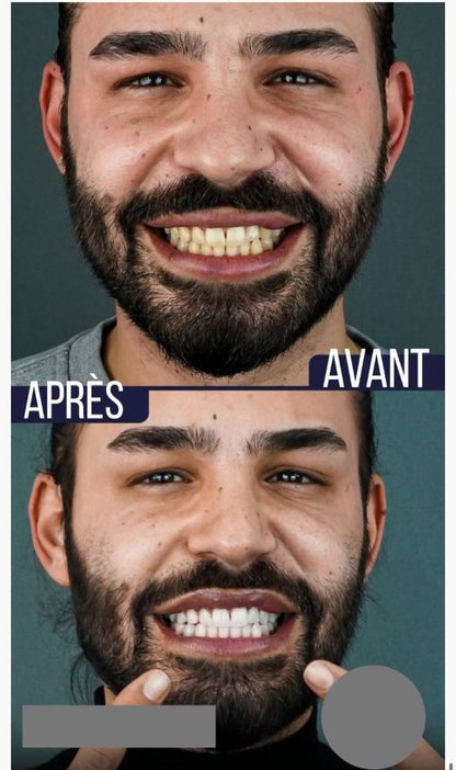 Retrouvez le sourire parfait dès aujourd'hui!